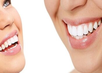 Dental Cosmetic Treatments