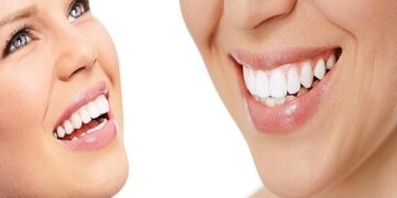 Dental Cosmetic Treatments
