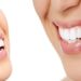Dental Cosmetic Treatments