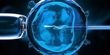 Everything You Need to Know About the ICSI Procedure